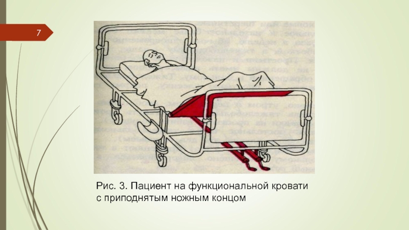 Положение пациента в постели схема 3 вида