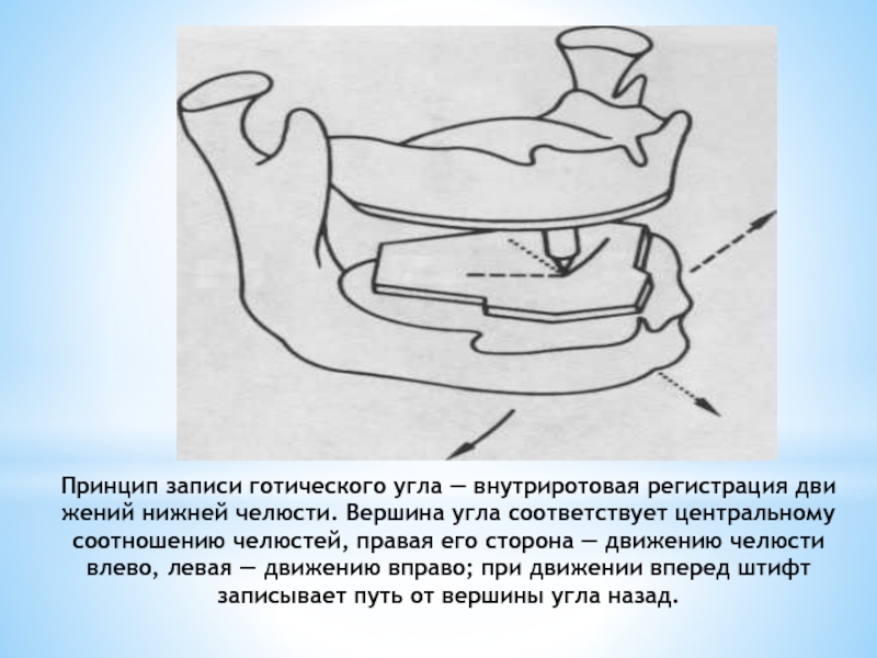 Методы определения центрального соотношения челюстей презентация