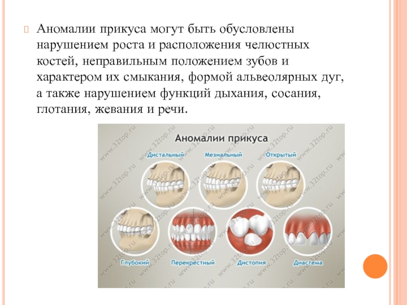 Профилактика зубочелюстных аномалий презентация