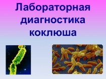 Коклюш