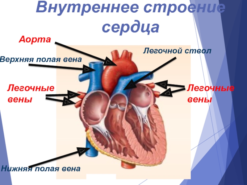 Легочный ствол рисунок