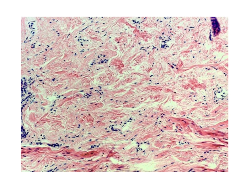 По изображению с микроскопа в препарате кожи пальца в плотной соединительной ткани