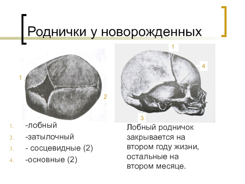 Роднички таблица. Передний Родничок черепа новорожденного. Роднички черепа анатомия. Кости черепа роднички. Сосцевидный Родничок черепа.