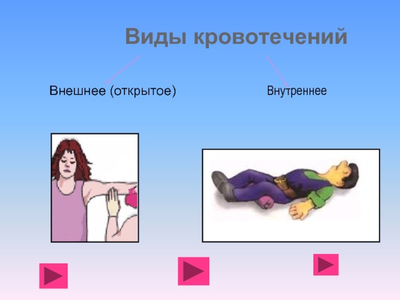 Рассмотрите рисунки 1 3 на которых изображены виды наружного кровотечения у человека