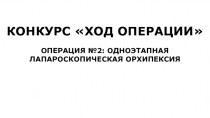 КОНКУРС ХОД ОПЕРАЦИИ
ОПЕРАЦИЯ №2: ОДНОЭТАПНАЯ ЛАПАРОСКОПИЧЕСКАЯ ОРХИПЕКСИЯ