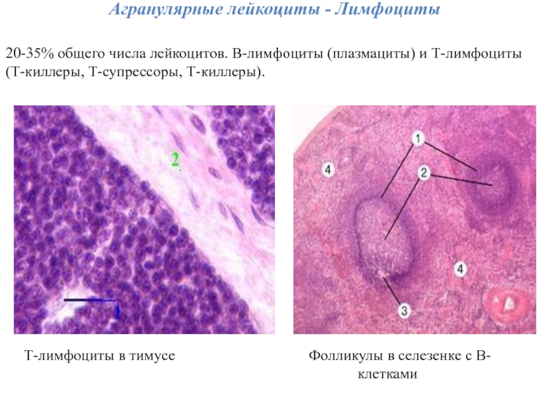 Селезенка лимфоциты. Т лимфоциты в тимусе. Лимфоциты агранулярные. Агранулярные лейкоциты. Лимфоциты в селезенке.