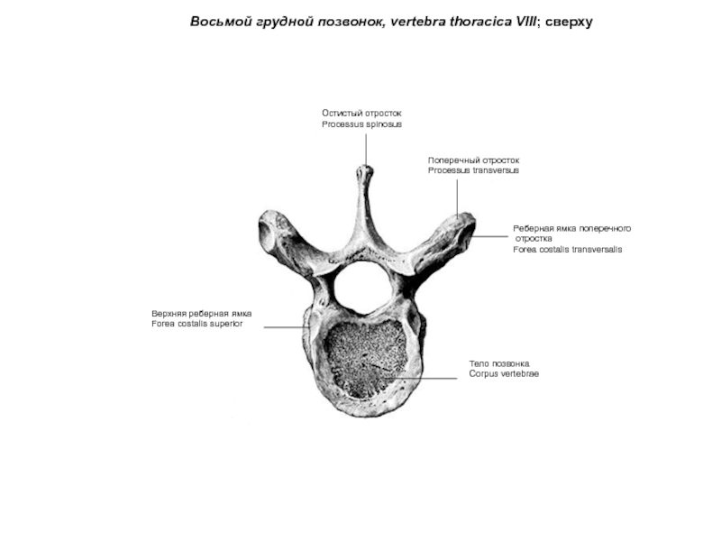 Остистый отросток позвонка на рисунке