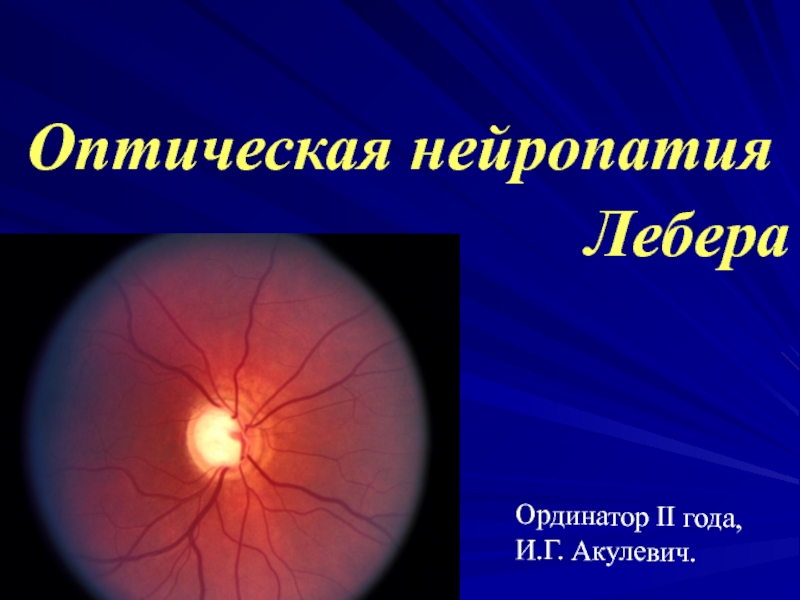 Презентация Оптическая нейропатия Лебера
Ординатор II года,
И.Г. Акулевич