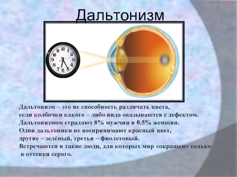 Дальтонизм это. Дальтонизм. Строение глаза дальтоника. Нарушения зрения дальтонизм. Дальтонизм дефект зрения.