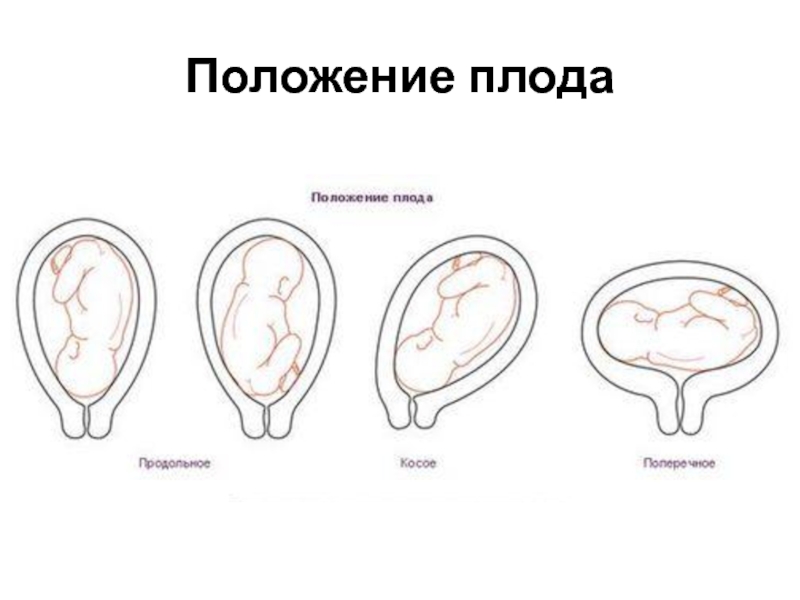 Задний передний вид