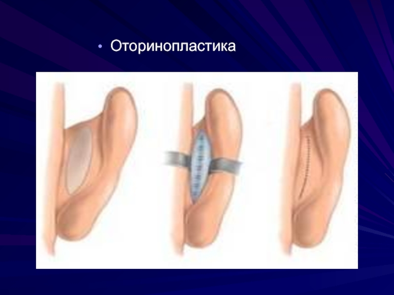 Пластическая хирургия презентация