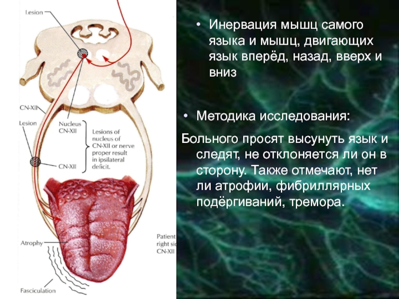 Болеть корень. Исследование мышц языка. Высовывание языка мышцы.