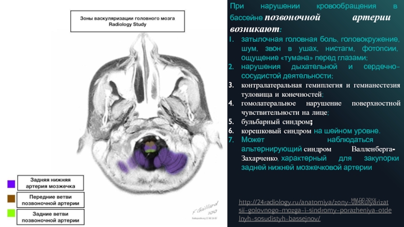 Бассейны кровоснабжения головного мозга схема