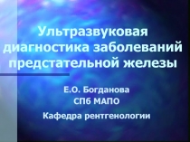 Ультразвуковая диагностика заболеваний предстательной железы