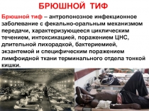 лекция БРЮШНОЙ  ТИФ 