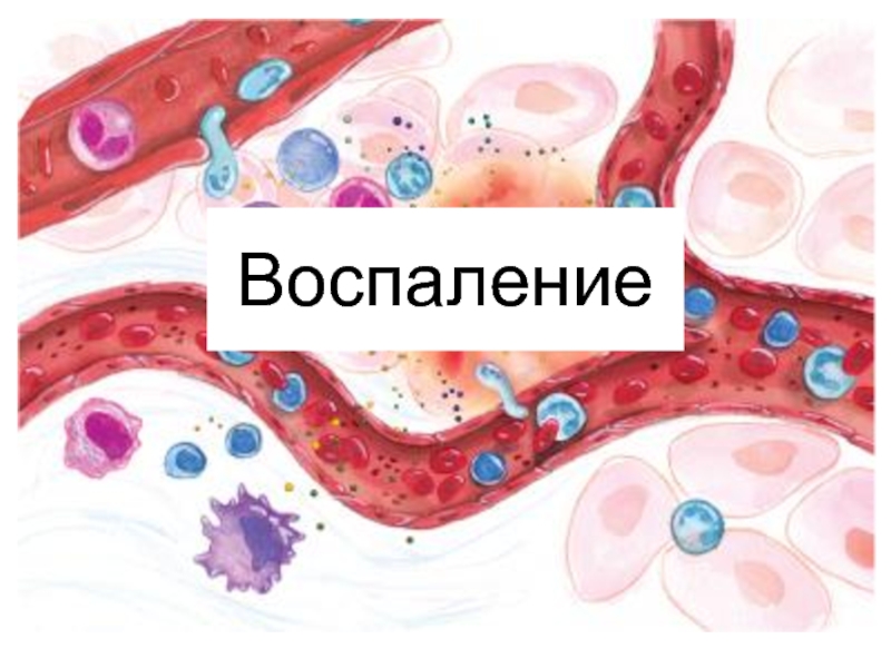 Воспаление