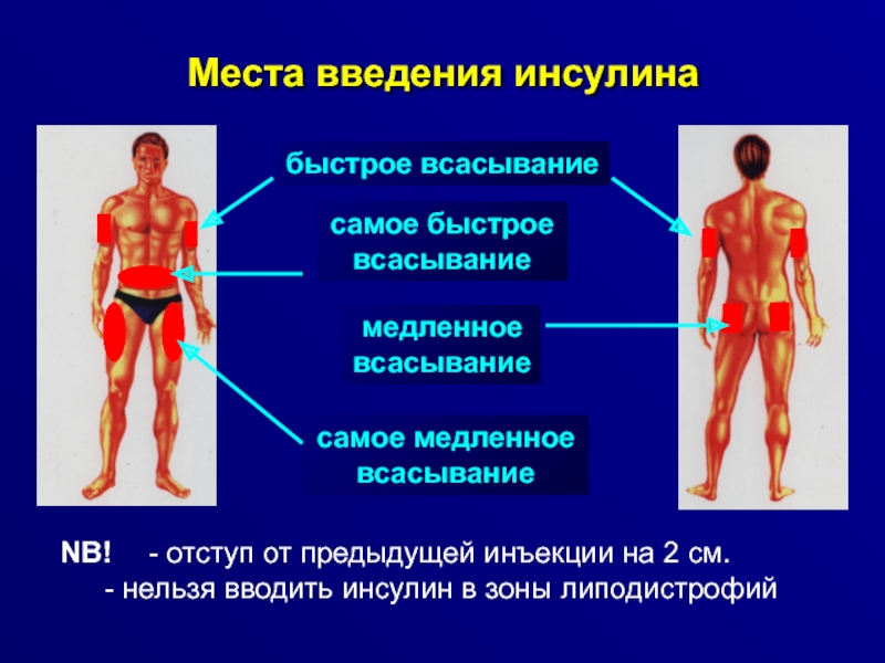 Картинка введение инсулина