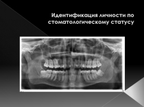 Идентификация личности по стоматологическому статусу
