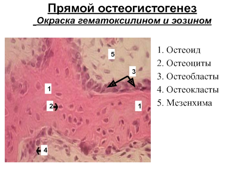 Непрямой остеогенез гистология рисунок