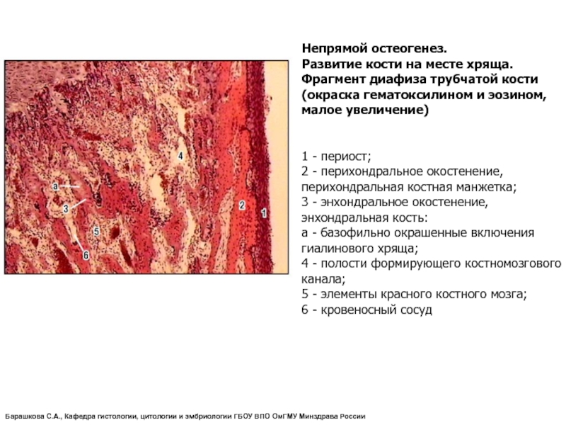 Схема непрямого остеогенеза гистология