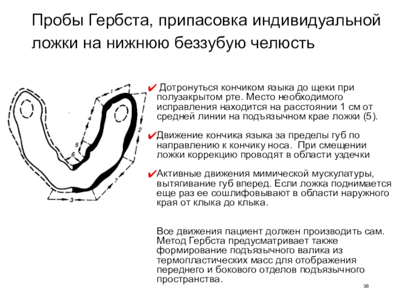 Индивидуальная проба. Пробы Гербста на нижней челюсти. Припасовка индивидуальной ложки на нижнюю челюсть. Припасовка индивидуальной ложки по методу Гербста. Припасовка индивидуальной ложки на нижнюю беззубую челюсть.