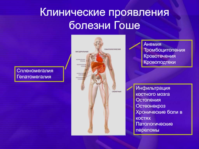 Буындық синдром презентация