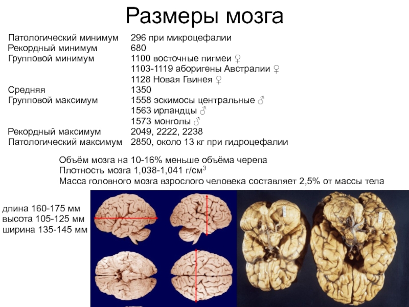 Объем головного мозга наибольшее. Объем головного мозга. Размер мозга человека. Средний объем мозга современного человека. Размеры головного мозга.