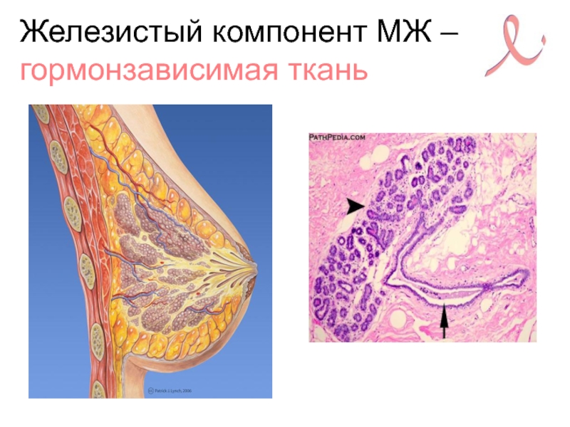 Ткань молочной железы. Молочная железа железистая ткань. Железистая ткань в груди. Железистая ткань молочной железы.