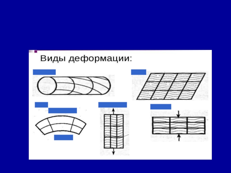 Продольная линейная деформация. Блокировка деформации. Деформация МДК.