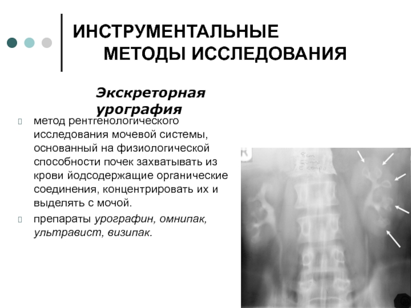 Инструментальные методы исследования мочевыделительной системы презентация