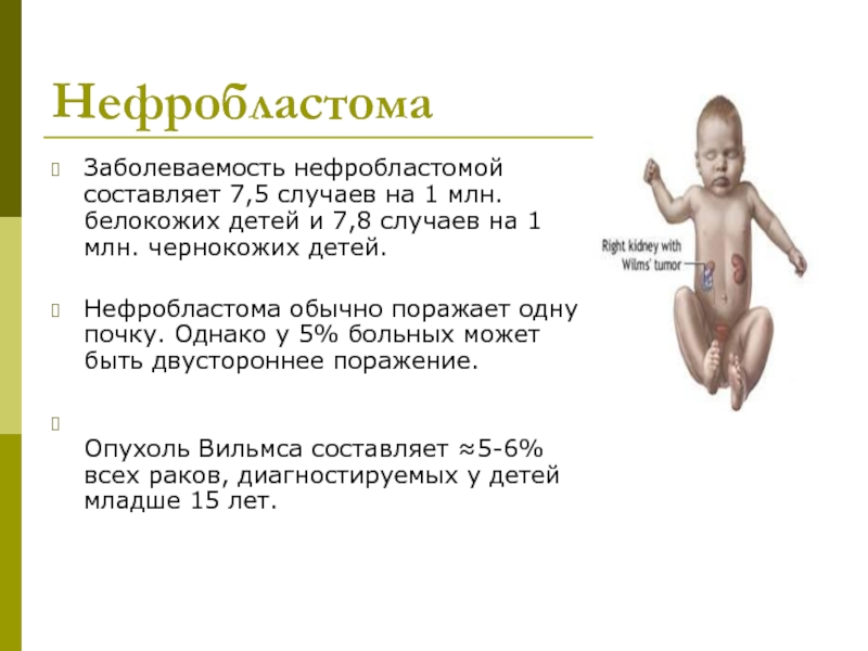 Нейробластомы у детей презентация