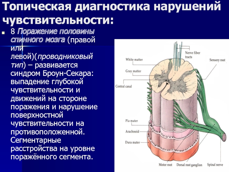 Глубокое нарушение. Топическая диагностика нарушений чувствительности. Нарушение глубокой чувствительности. Поражение глубокой чувствительности. Топическая диагностика поражения спинного мозга.