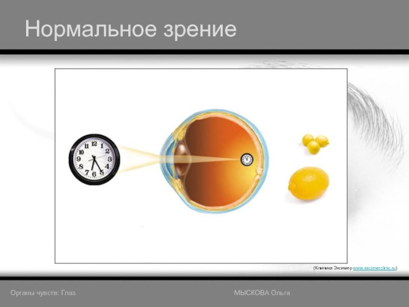 Нормальное зрение(Клиника Эксимер www.excimerclinic.ru)Органы чувств: Глаз