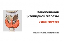 Заболевания щитовидной железы
ГИПОТИРЕОЗ
Вашеко Алла Анатольевна