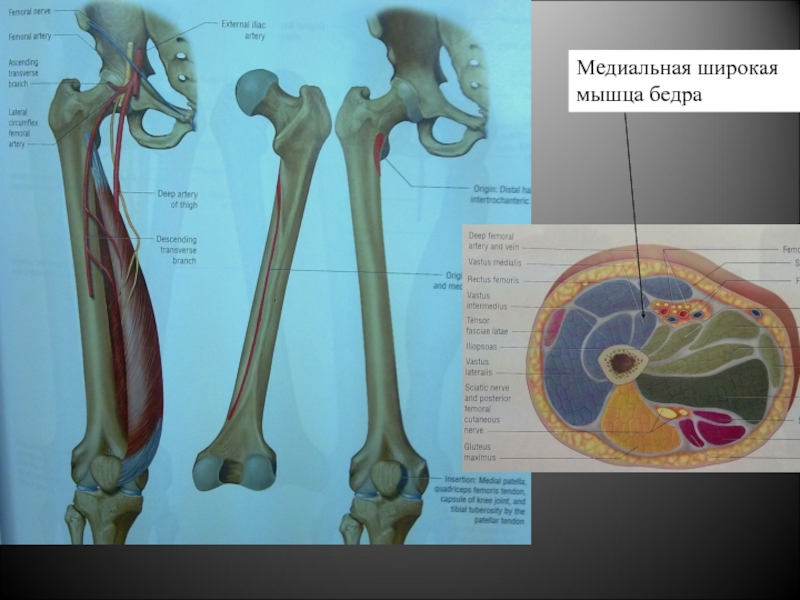 Нормальная анатомия. Меиальнаяширокая мышца бедра. Медиальная широкая мышца. Медиальная широкая мышца бедра анатомия. Медиальная широкая широкая мышца бедра.