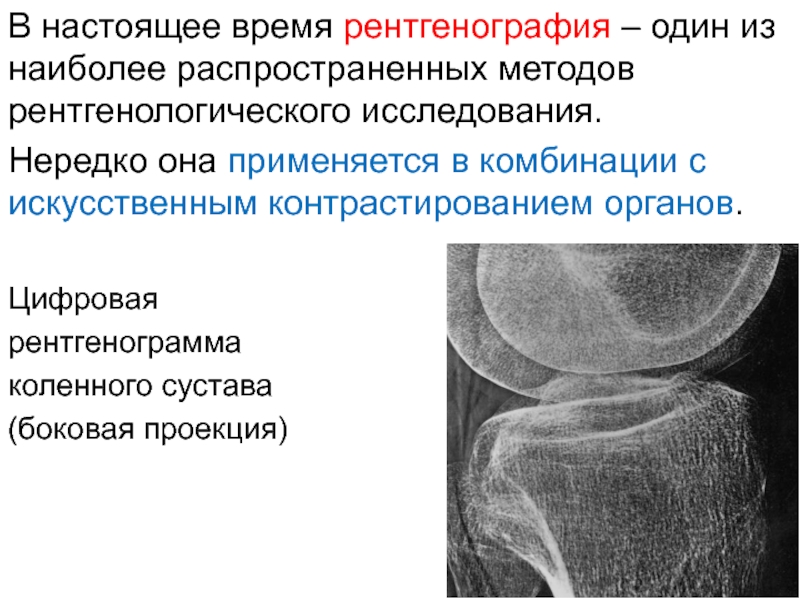 Рентгенография с прямым увеличением изображения применяется тест