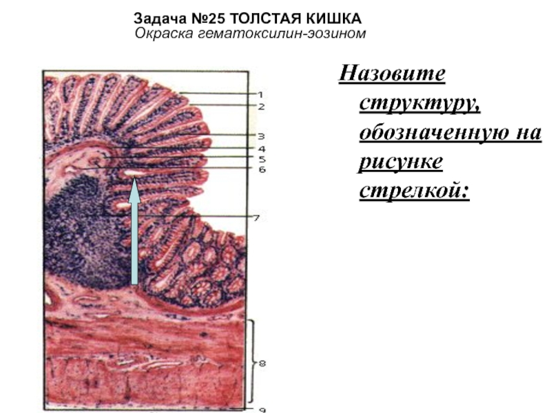 Толстая кишка рисунок гистология