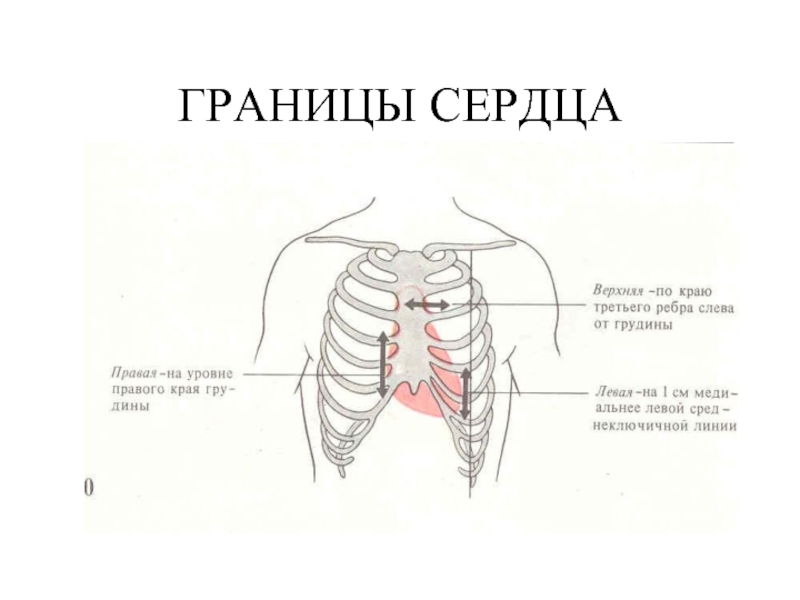 Перкуссия сердца схема