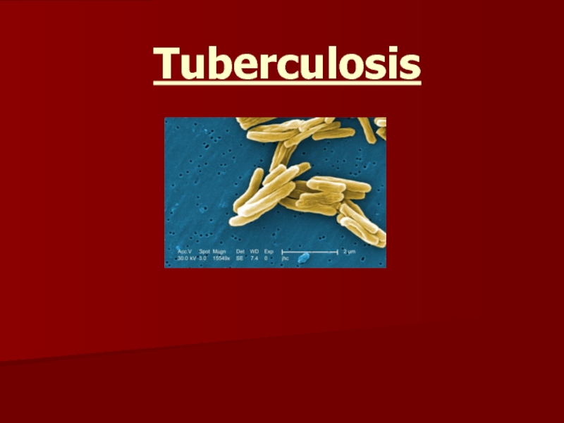 Презентация Tuberculosis