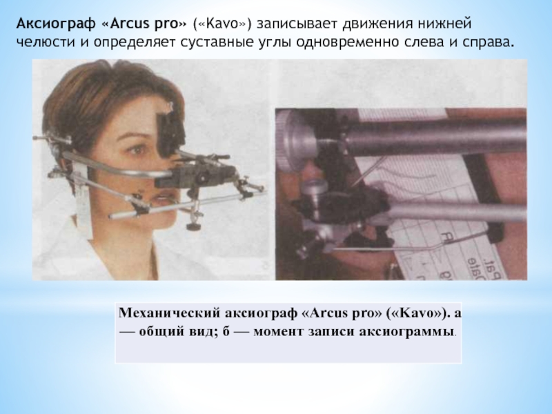 Аксиография в стоматологии презентация