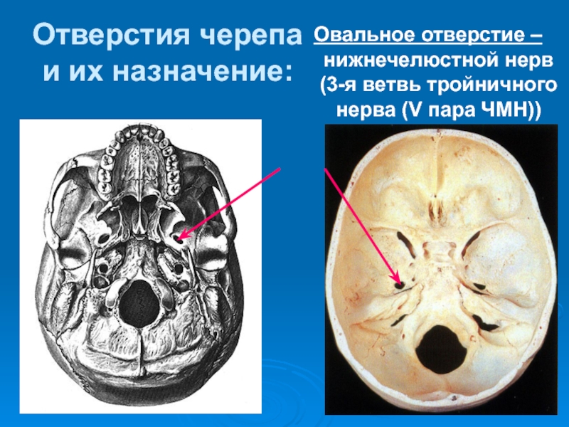 Проникающая в полость черепа. Остистое отверстие в полости черепа. Шилососцевидное отверстие нерв. Овальное отверстие черепа. Круглое отверстие черепа.