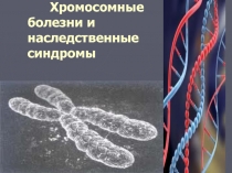 Хромосомные болезни и наследственные синдромы