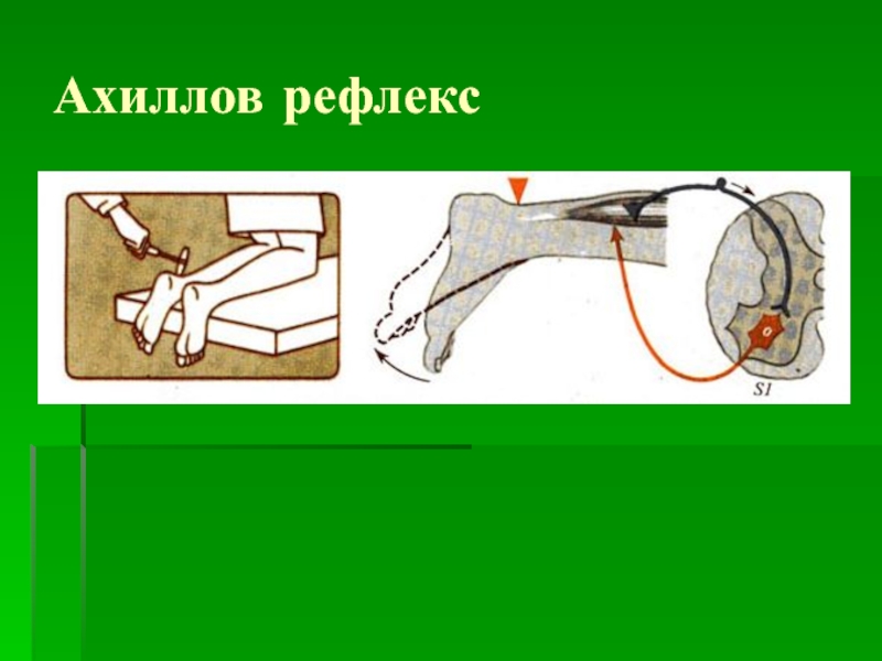 Ахиллов рефлекс схема