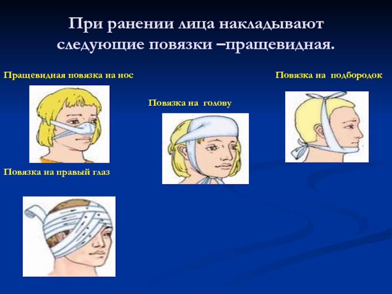 Основные способы при ранении головы