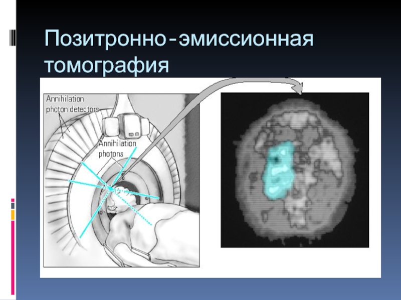 Методы позитронно эмиссионной томографии