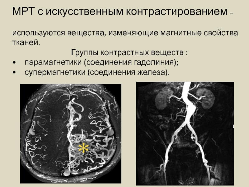 Методы контрастирования изображения