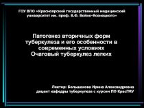  Патогенез вторичных форм туберкулеза и его особенности в современных условиях Очаговый туберкулез легких
