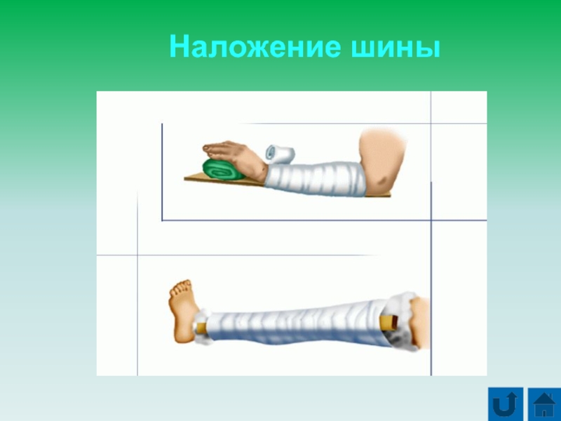 Первая помощь при повреждении скелета