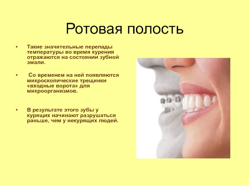 Рта класс. Влияние курения на полость рта. Влияние курения на ротовую полость. Ротовая полость входные ворота. Влияние табака на ротовую полость.