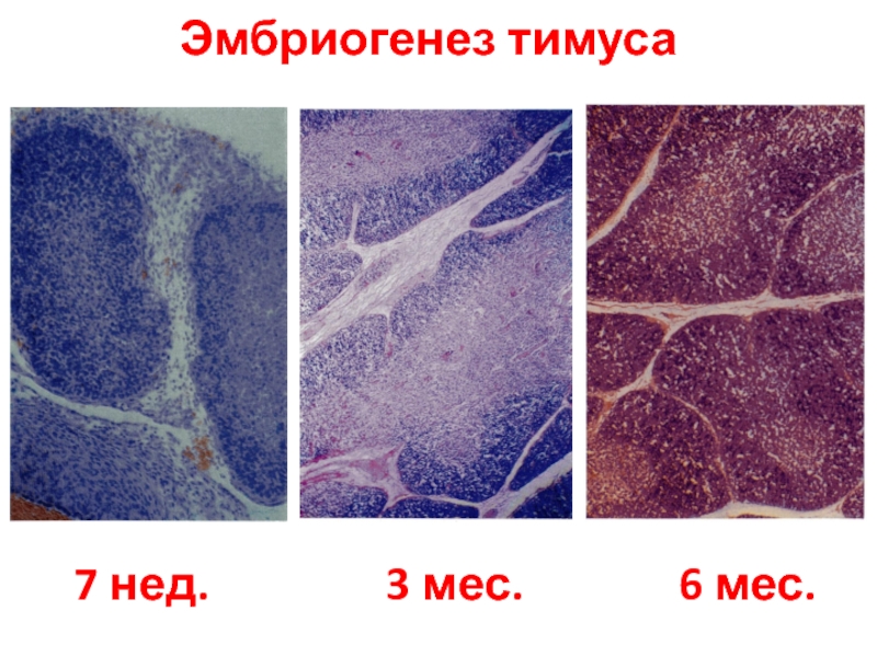 Тимус новорожденного гистология рисунок